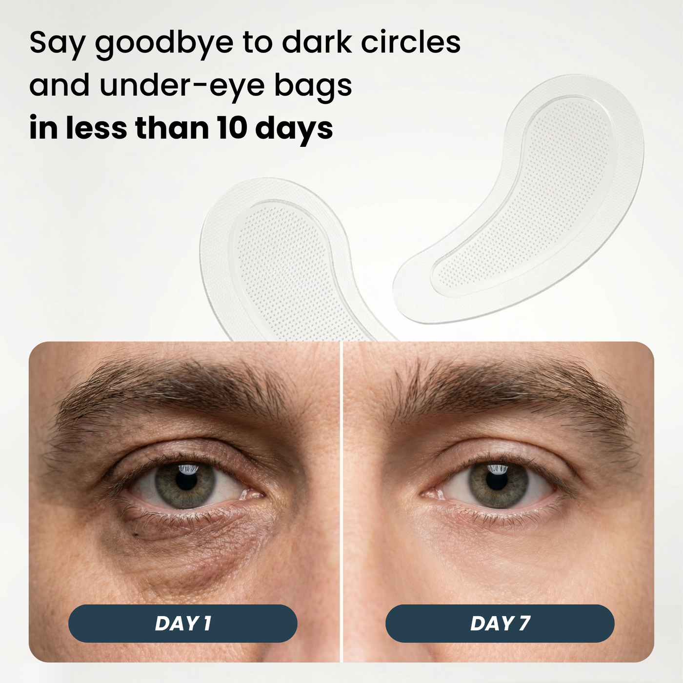 Microneedle eye patch result example