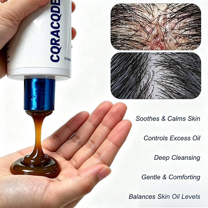 Folliculitis Shampoo for Itchy, Flaky Scalp - Purifying Formula for a Soothed, Balanced Scalp & Oily Scalp Care🧴