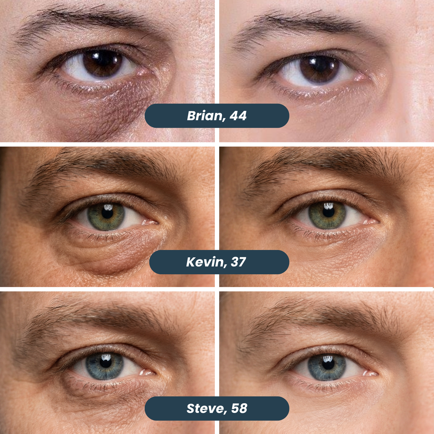 Microneedle eye patch before and after examples