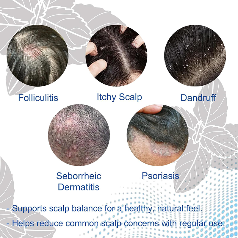 Folliculitis Shampoo for Itchy, Flaky Scalp - Purifying Formula for a Soothed, Balanced Scalp & Oily Scalp Care🧴