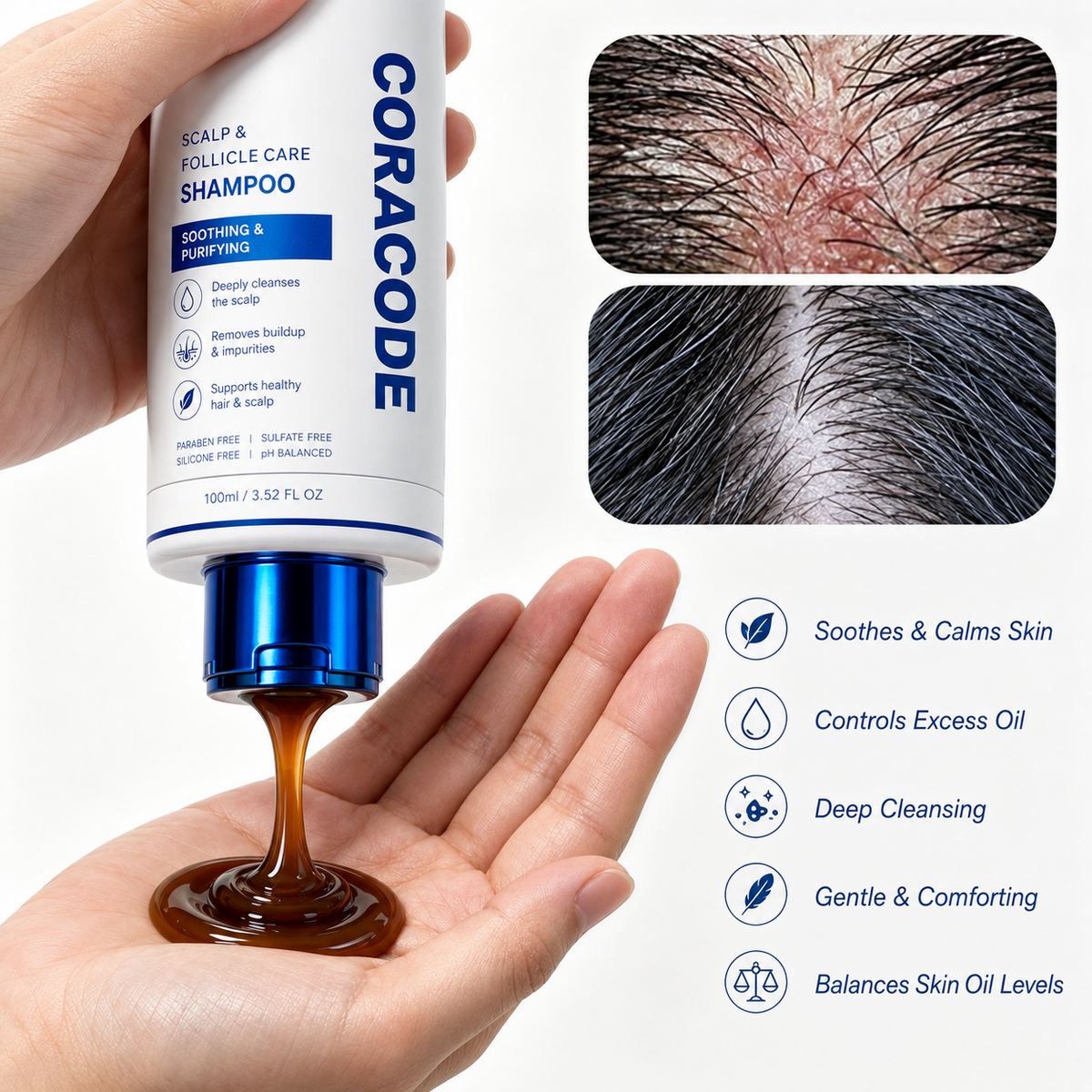 Folliculitis Shampoo for Itchy, Flaky Scalp - Purifying Formula for a Soothed, Balanced Scalp & Oily Scalp Care🧴
